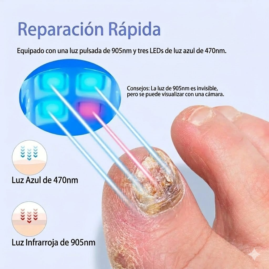 NailClear™ Láser para reparación de uñas