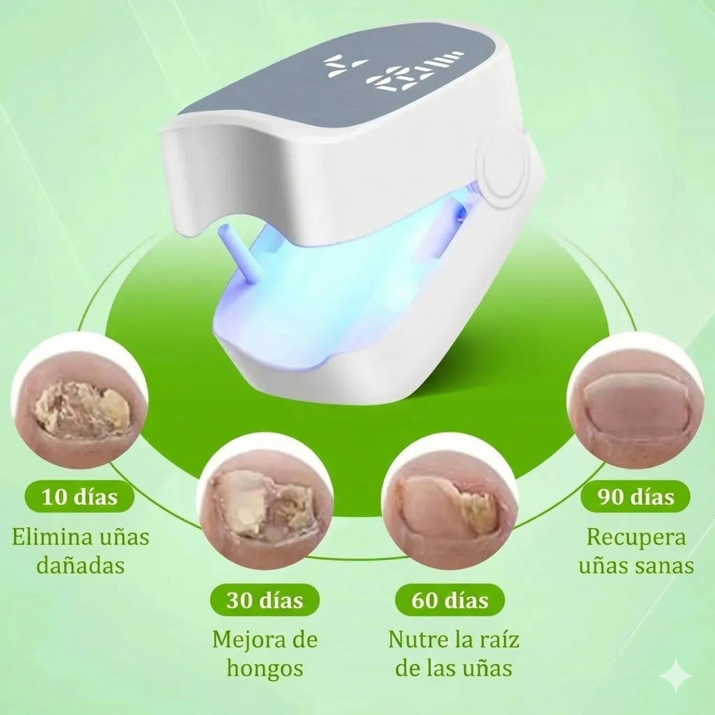 NailClear™ Láser para reparación de uñas